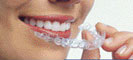 Invisalign for General Practitioners